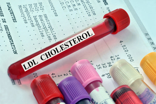 Should You Raise Your Cholesterol Levels?